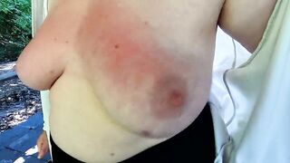 Red and swollen tits at bbq place - 4 image